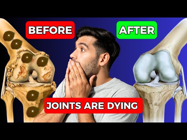 Revive Your Joints! 10 Essential Tips for Optimal Joint Health!