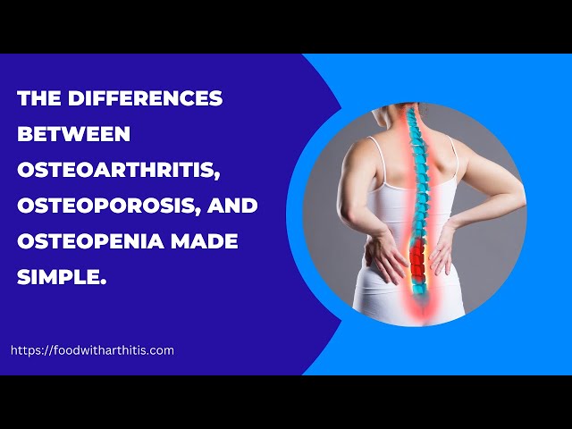 The Differences Between Osteoarthritis, Osteoporosis, and Osteopenia Made Simple.