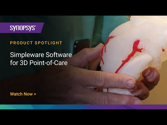 Simpleware 3D Point-of-Care Solutions | Synopsys