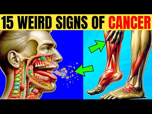 WARNING! 15 EARLY SIGNS OF CANCER MOST PEOPLE MISS! - DON’T IGNORE!