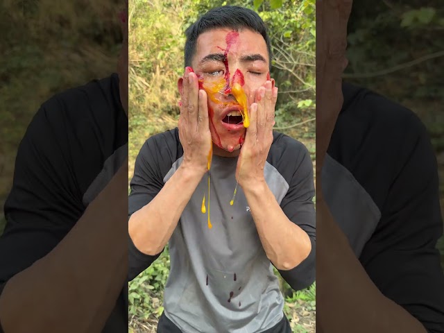 Wilderness Survival Hack: Treat Wounds Effectively with an Egg!