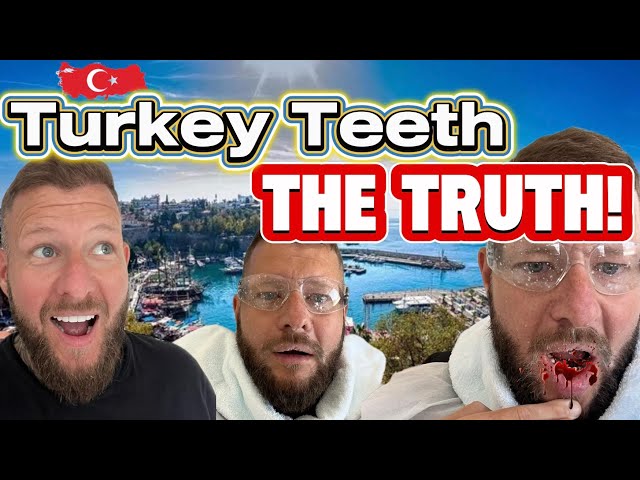 7K Turkey Teeth The Truth ! Antalya