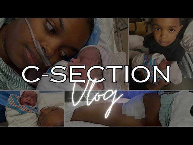 OFFICIAL BIRTH OF MY TWINS RAW & UNCUT | EMERGENCY C-SECTION