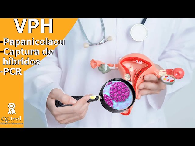 HPV: What you should know about the genotypes and the tests for its detection