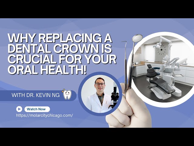 Why Replacing a Dental Crown Is Crucial for Your Oral Health!