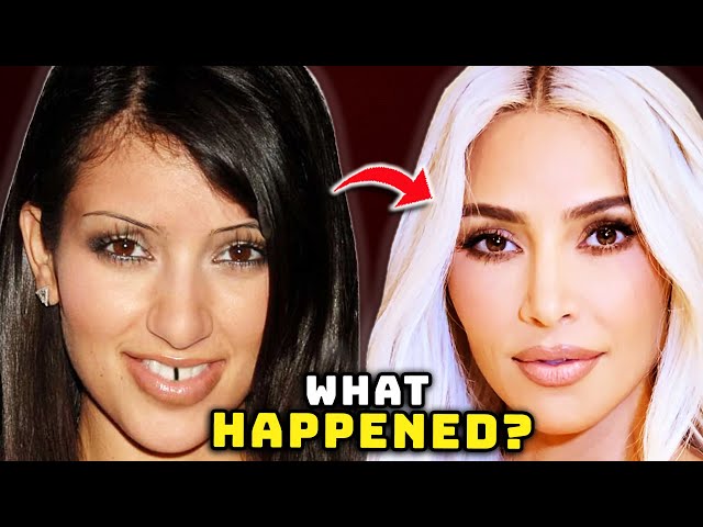 Kim Kardashian's Face - Before and After