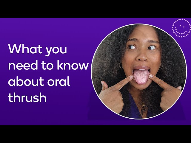 Understanding Oral thrush:  The causes, symptoms, and prevention tips