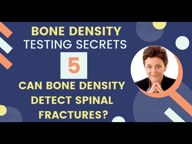 Bone Density Testing Secret 5: Can Bone Density Detect Spinal Fractures?