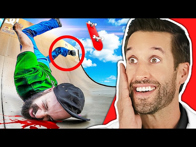 ER Doctor REACTS to Most PAINFUL Skateboarding Fails Ever