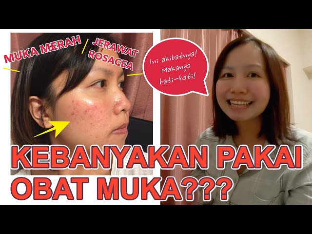 KULIT MUKA RUSAK DAN MERAH? MUNGKIN ROSACEA