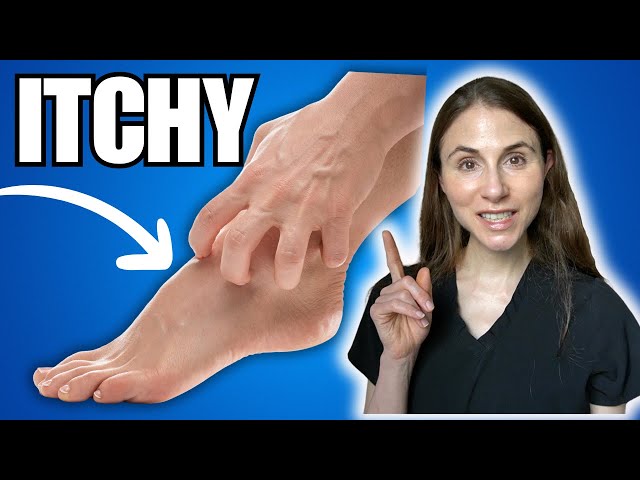 6 Causes Of Itchy Feet & How To Get Relief