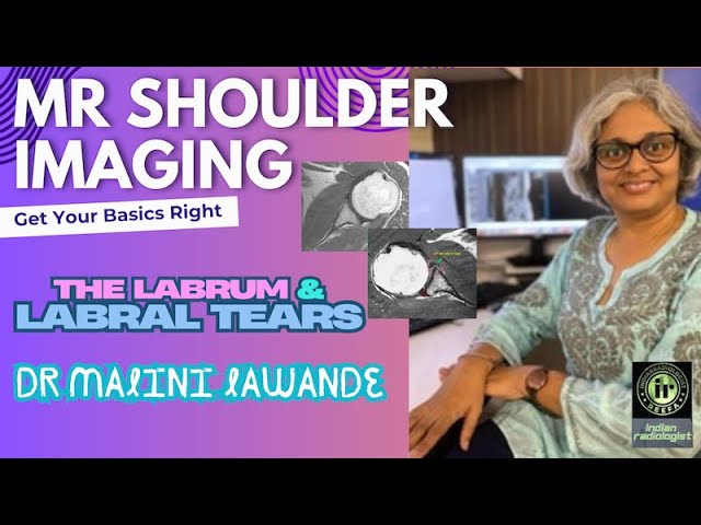 DR MALINI LAWANDE | Labrum & Labral Tears | #mrishoulder