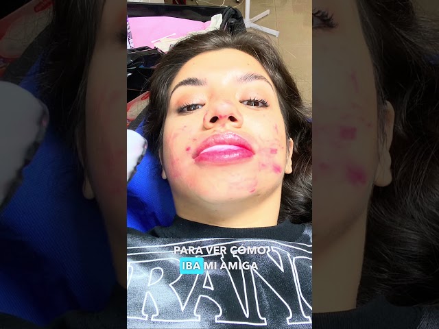 Tatuarme los Labios: Mi Experiencia más DOLOROSA! 👄😰 #storytime #beauty #skincare  #experience