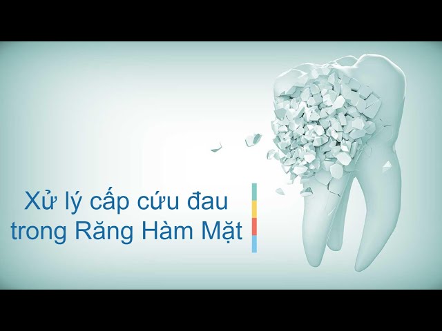 Xử Trí Cấp Cứu Đau Trong Răng Hàm Mặt - Nguyên Nhân, Các Hội Chứng, Triệu Chứng - Chữa Răng Nội Nha