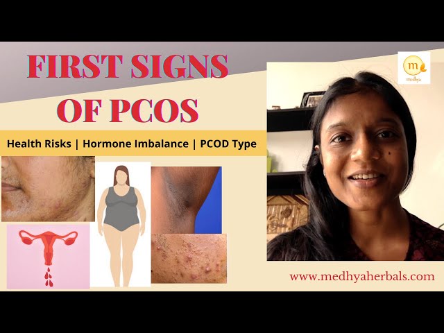 PCOD | PCOS Symptoms | First Signs of Polycystic Ovarian Syndrome