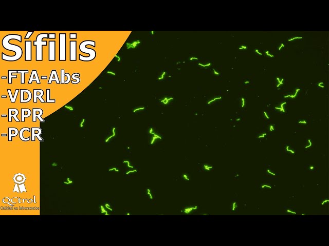 SYPHILIS: Progress of the disease and laboratory tests to detect it