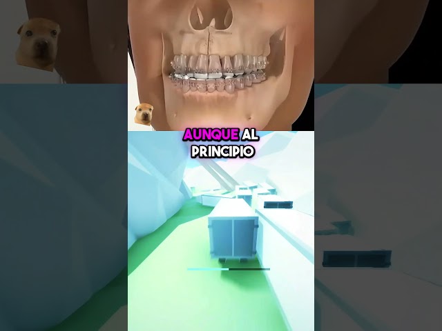 Transformación con Brackets🦷