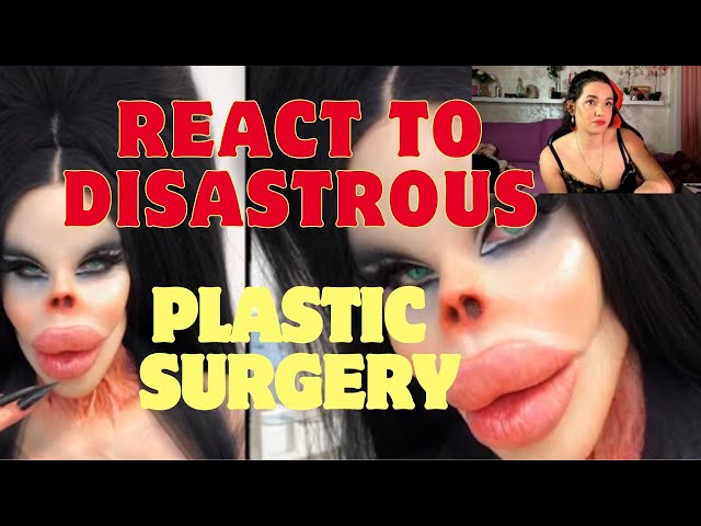 Twitch Streamer Girl Reacts to Disastrous Plastic Surgery