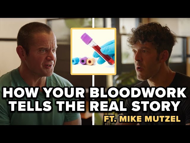 How Your Blood Work Tells the Real Story: Glucose, Triglycerides & Metabolic Health