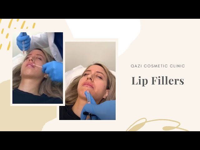 Lip Fillers with Restylane Kysse | Live with Dr. Nadir Qazi