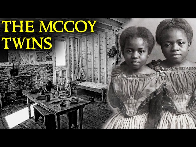 The Shocking Case of the Conjoined McCoy Twins