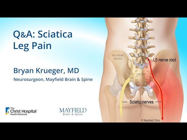 Q&A: Sciatica, Leg Pain w/ Dr.  Bryan Krueger