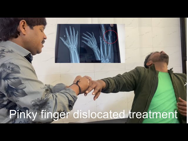 Pinky finger dislocated treatment ajmer ||jai bhagwan therapy centre Chiropractor in India