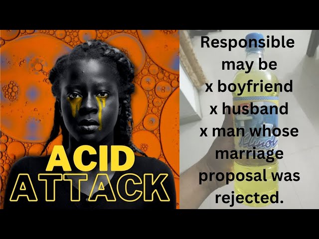 ACID ATTACH BY A MAN WHOSE MARRIAGE PROPOSAL WAS REJECTED.