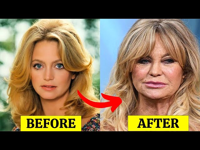 20 Celebrities Who Aged HORRIBLY (Fans Are SHOCKED)