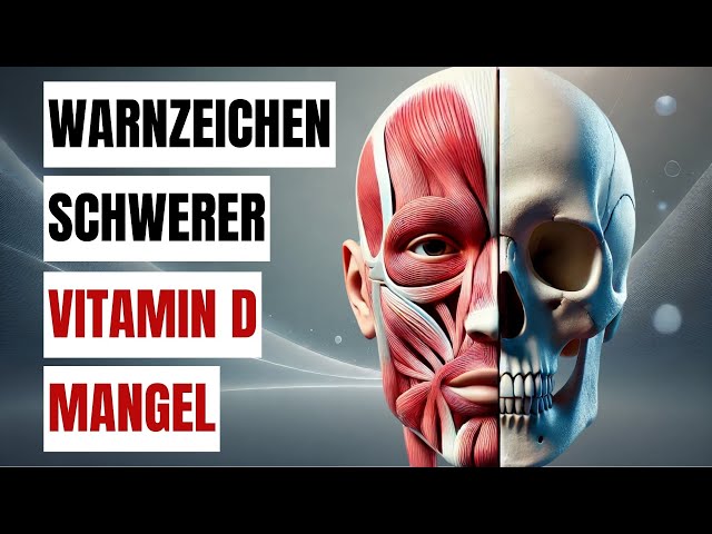 14 ANZEICHEN FÜR EINEN VITAMIN D MANGEL