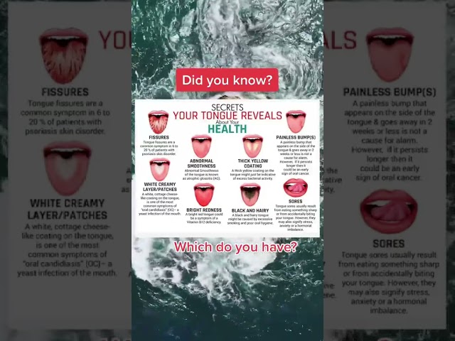 Does your tongue look like these? #factsvideo  #tonguetwisters #factsdaily #healthyliving #facts