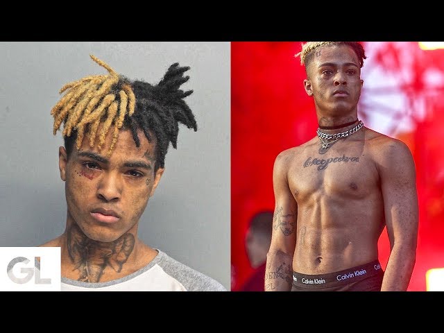 XXXTENTACION'S Dreadlocks