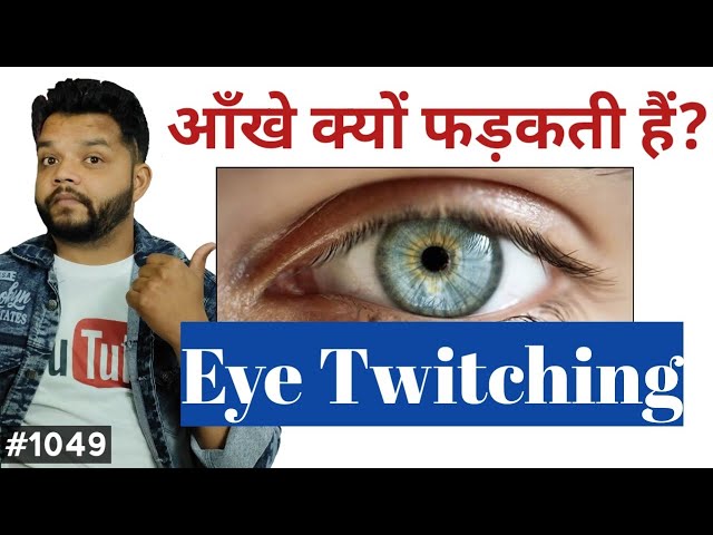 आंख क्यों फडकती है 🔥 Eye Twitching Causes In Hindi | Gyanear