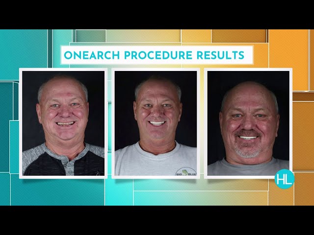 Houston periodontist restoring patients’ smiles with dental implants