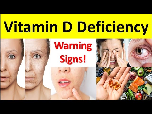 विटामिन D की कमी के 8 खतरनाक संकेत | Vitamin D Deficiency के Symptoms और उपाय | MK Biology