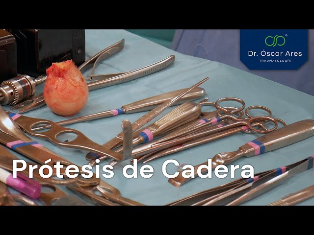 Prótesis de Cadera - Dr. Oscar Ares