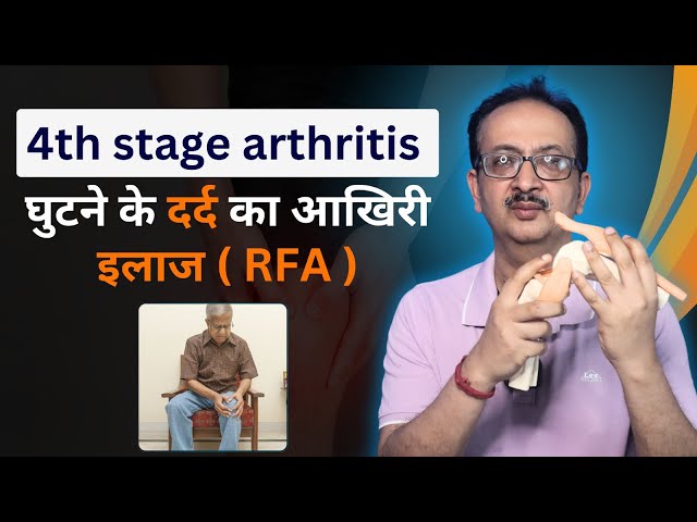 4th Stage Arthritis | कितना भी पुराना दर्द हो। घुटने के दर्द का आखिरी इलाज |  ghutno ke dard ka ilaj