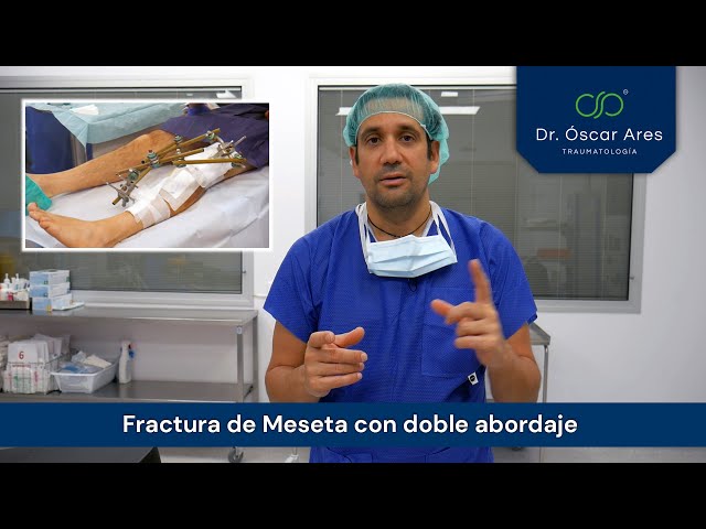 Fractura de Meseta con doble abordaje - Dr. Oscar Ares