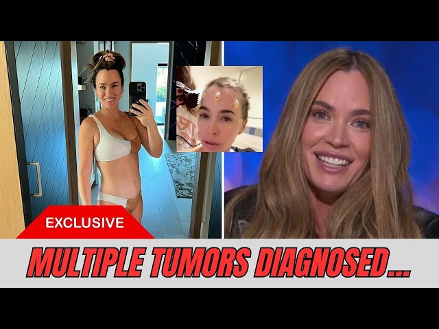 Teddi Mellencamp reveals doctors found ‘MULTIPLE TUMORS’ on her brain THAT IS GROWING FROM 6 MONTHS