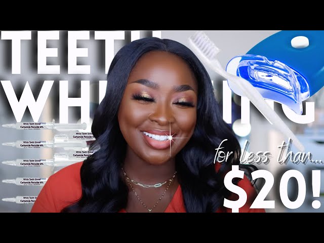 HOW TO: WHITEN TEETH AT HOME - AFFORDABLE TEETH WHITENING AMAZON CHEAP | Mena Adubea