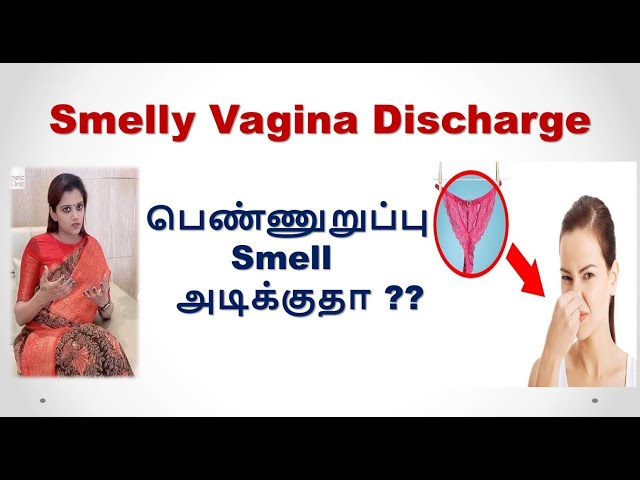 Smelly Vaginal Discharge | STD Infections | பெண்ணுறுப்பு Smell அடிக்குதா? | Dr. Deepa Ganesh.