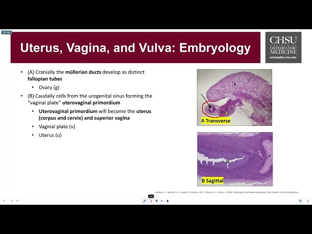 Female Reproductive Uterine Pathology