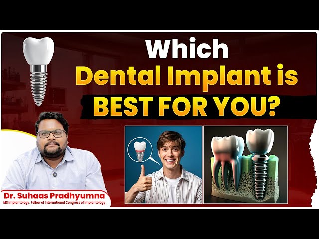 Dental Implant Surgery || Step by Step Guide to Dental Implant Procedure || Eledent Dental Hospitals