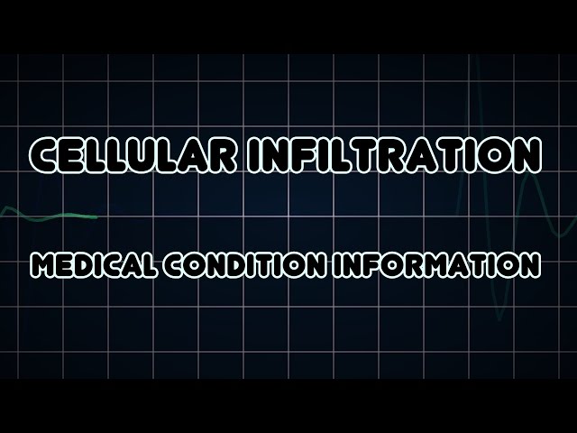 Cellular infiltration (Medical Condition)