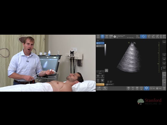 Point of Care Lung Ultrasound (POCUS)