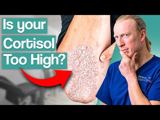 Signs Of High Cortisol Levels: Symptoms and Treatment Options