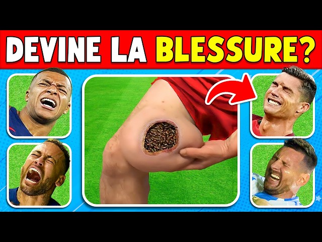 Qui s'est BLESSÉ...?💔🤕 Cartons Rouges, Blessures, Pires Moments des Footballeurs ⛑️⚽ Quiz Football