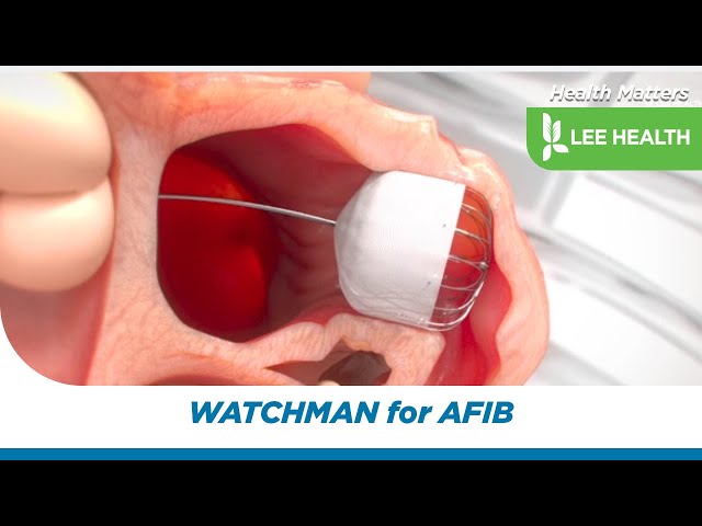 WATCHMAN for AFIB