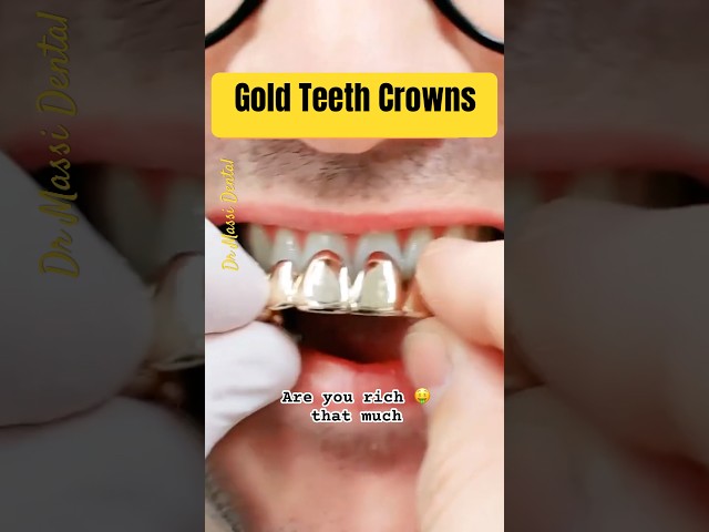 Golden Teeth ! Are you Rich 🤑