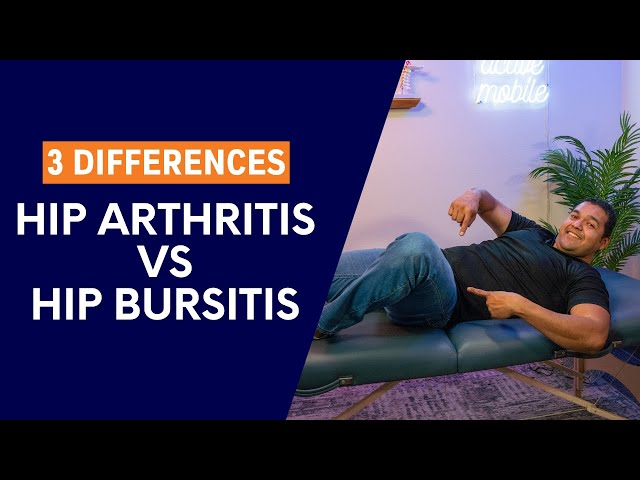 3 Major Differences Between Hip Pain From Arthritis And Bursitis